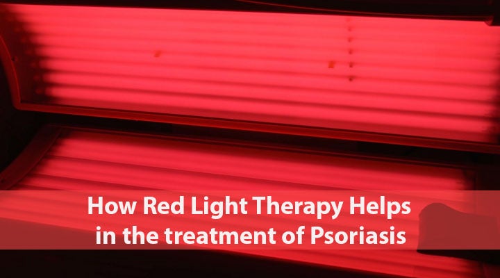 Red Light Therapy For Psoriasis