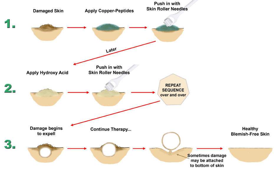 copper peptide 2