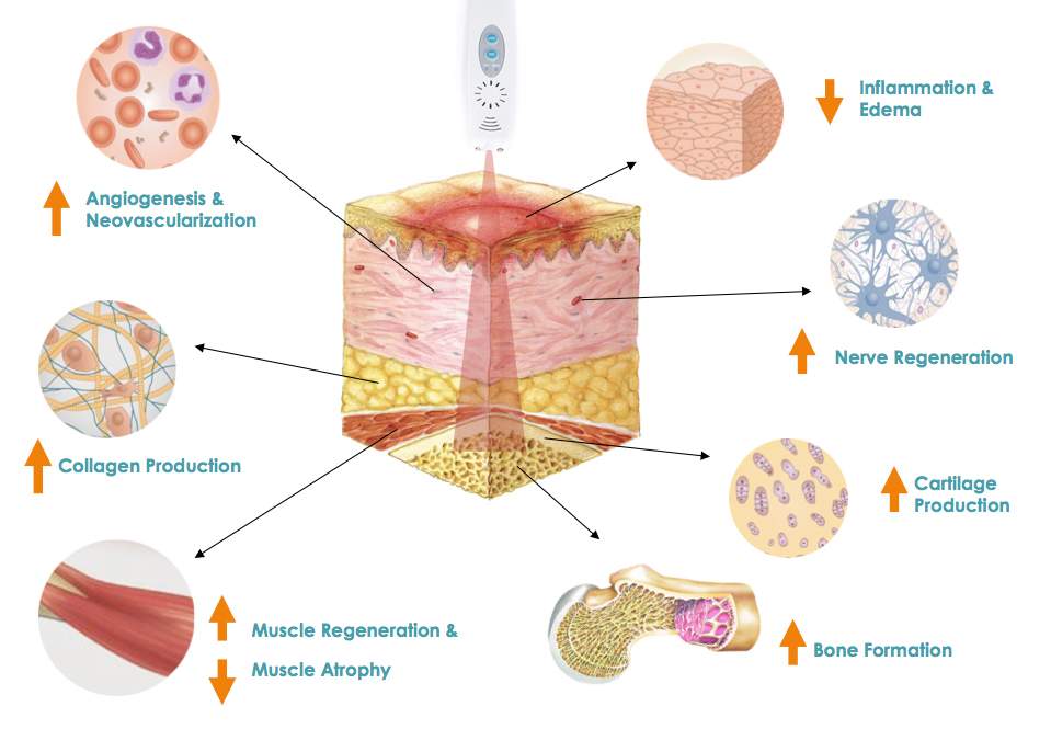 low-level-light-therapy-effects