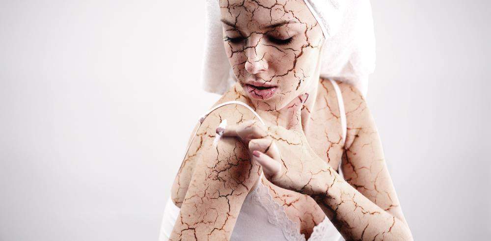 Dry Skin on Body