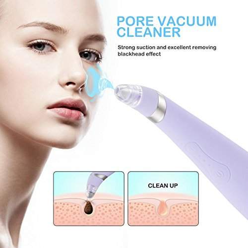 facial_pore_vacuum